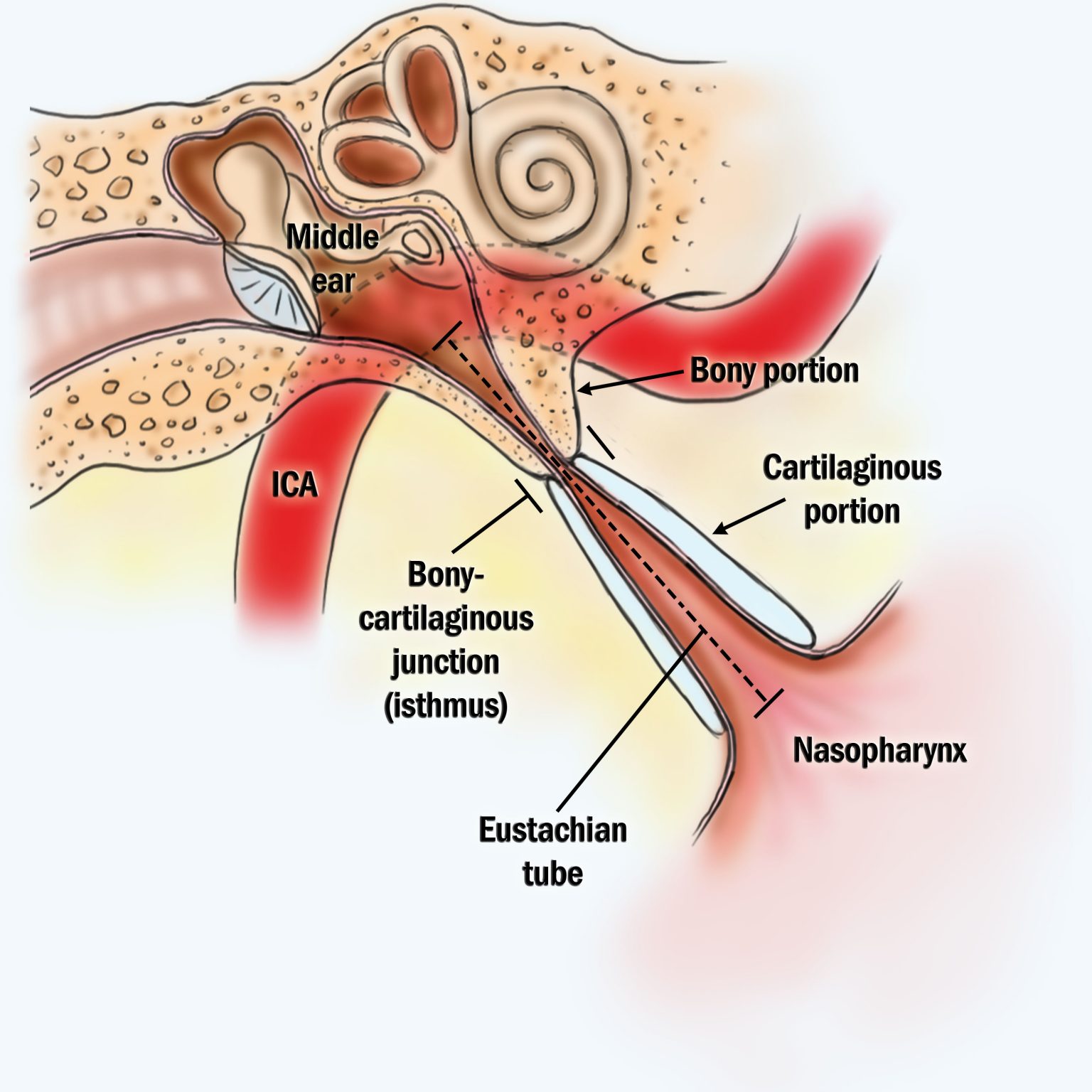 eustachian-tube-dysfunction-easmed